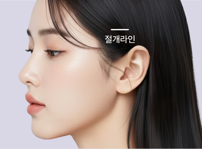 리팅 미니리프팅의 절개라인