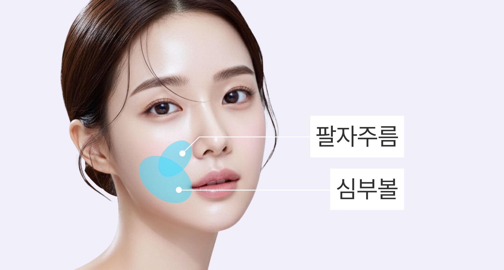 팔자주름, 심부볼