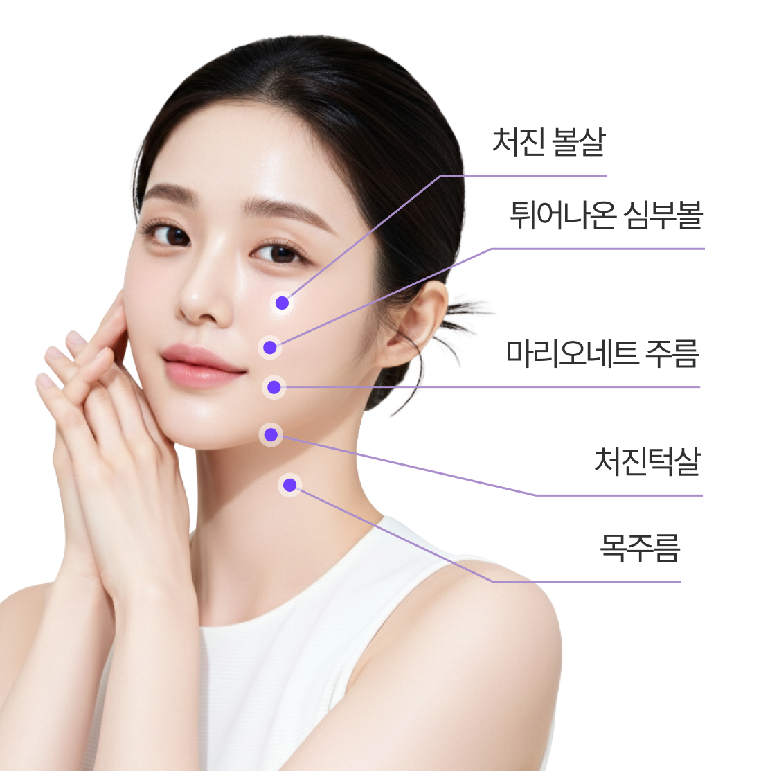 브이넥 리프팅 개선 부위 : 처진 볼살, 튀어나온 심부볼, 마리오네트 주름, 처진 턱살, 목주름