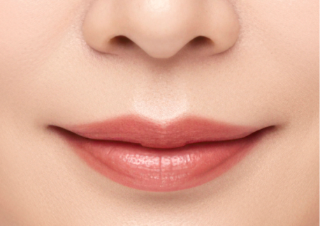 인중축소술 1단계