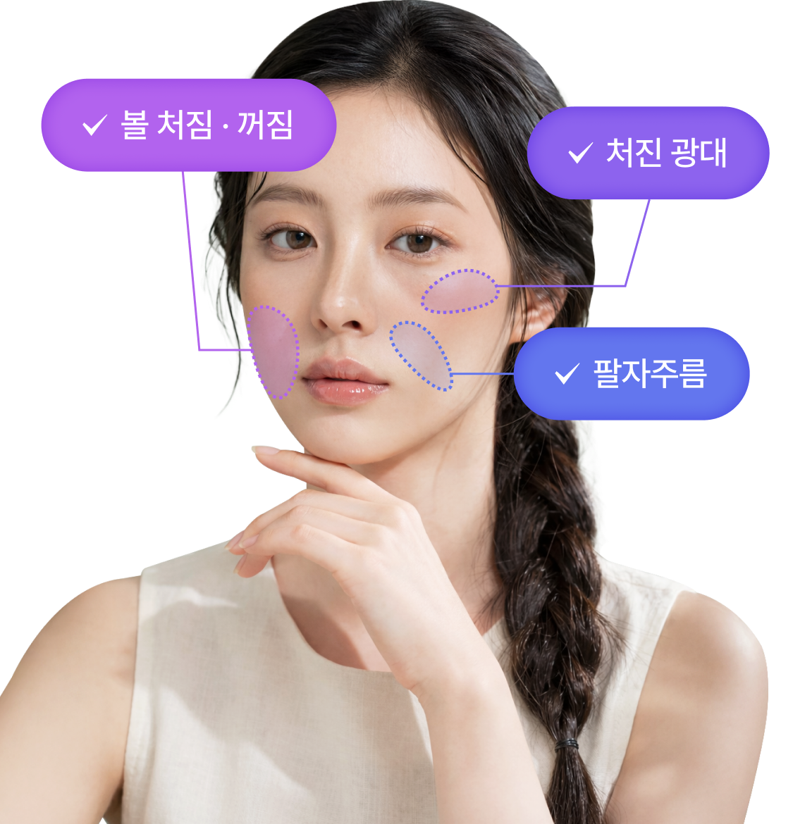 퀵거상 개선부위