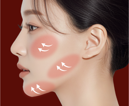 미니윤곽술(단독)